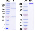 Anti-Human VEGF Reference Antibody (Bd0801) – Figure 1 of 3