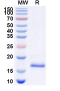 SDS-PAGE for Anti-Human AGTR1 Nanobody (SAA1005)