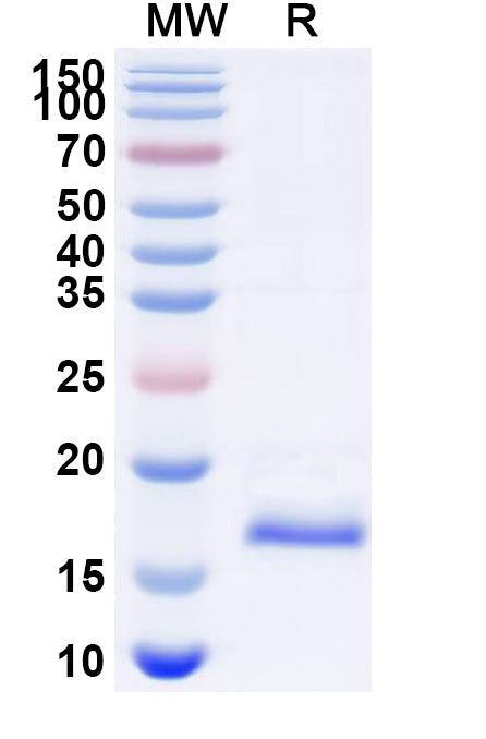 SDS-PAGE for Anti-Human AGTR1 Nanobody (SAA1005)