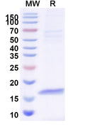 SDS-PAGE for Anti-Human H2AX Nanobody (SAA1140)