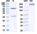 SDS-PAGE for Anti-Human NTF3/NGF2 Antibody (SAA1952)