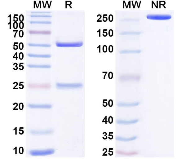 SDS-PAGE for Anti-Human CALCR/Calcitonin receptor/CT-R Antibody (SAA1757)