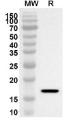 Western blot analysis was performed using anti-Human CALCR/Calcitonin receptor/CT-R polyclonal antibody at 1ug/mL on recombinant Human CALCR/Calcitonin receptor/CT-R (Catalog No. HB973012).