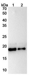 Anti-Human IL11 Reference Antibody (X203) – Figure 1 of 2