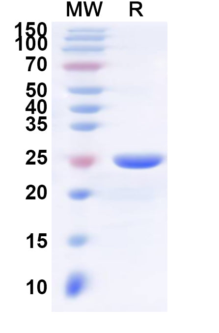 Recombinant Human HLA-DPA1 Protein, N-His