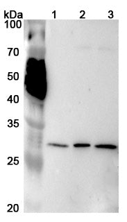 Western blot analysis was performed using anti-PSMA4 polyclonal antibody at 1μg/ml on various samples.
Lane 1: BxPC-3 cell lysate
Lane 2: K562 cell lysate
Lane 3: U937 cell lysate
