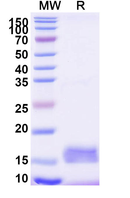 SDS-PAGE for Anti-Human CD9 Nanobody (SAA0905)