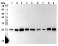 Western blot analysis was performed using anti-PSMB5 polyclonal antibody at 1μg/ml on various samples.
Lane 1: NIH3T3 cell lysate
Lane 2: Hela cell lysate
Lane 3: HepG2 cell lysate
Lane 4: Jurkat cell lysate
Lane 5: LO2 cell lysate
Lane 6: U2OS cell lysate
Lane 7: K562 cell lysate
Lane 8: PC-3 cell lysate
Lane 9: MCF-7 cell lysate