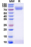 Recombinant Human CD119/IFNGR1 Protein, C-Fc