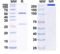 SDS-PAGE for Anti-Human PRDX6 Antibody (SAA1620)