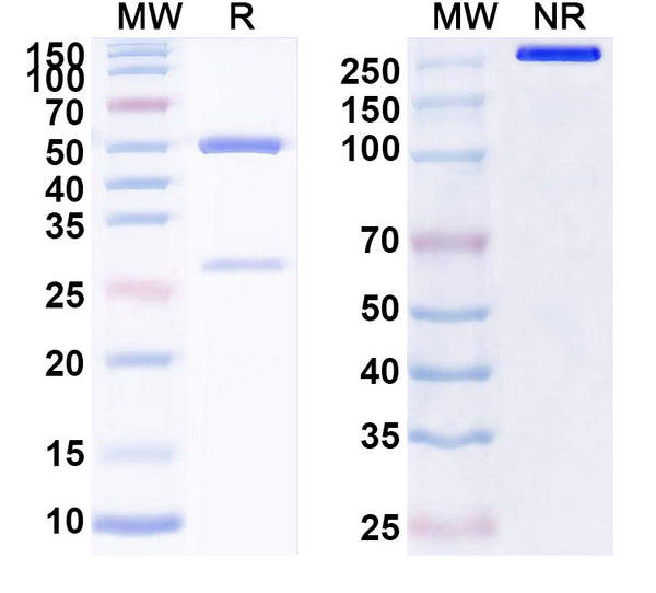 SDS-PAGE for Anti-Human PRDX6 Antibody (SAA1620)