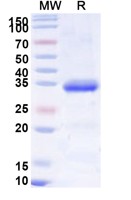Recombinant Human IGFBP5 Protein, N-His-SUMO&C-Strep