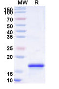 Recombinant Human RPS6 Protein, N-His