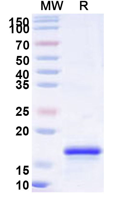 Recombinant Human RPS6 Protein, N-His