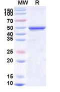 Recombinant Human KIFC1 Protein, N-His