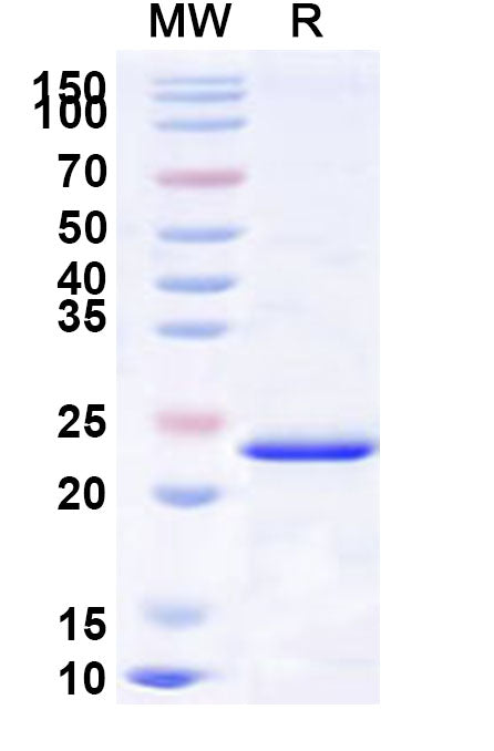 Recombinant Human ONECUT2 Protein, N-His