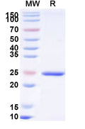Recombinant Human KCTD5 Protein, N-His