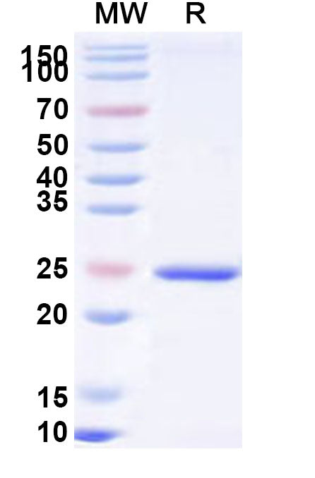 Recombinant Human KCTD5 Protein, N-His