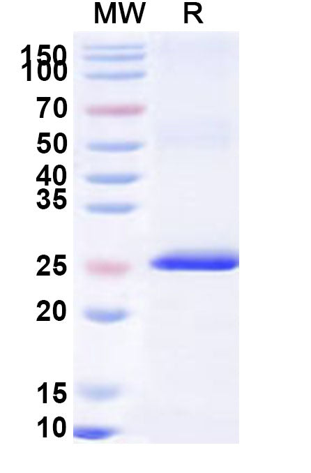 Recombinant Human XPO4 Protein, N-His