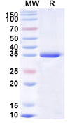 Recombinant Human EYA2 Protein, N-His