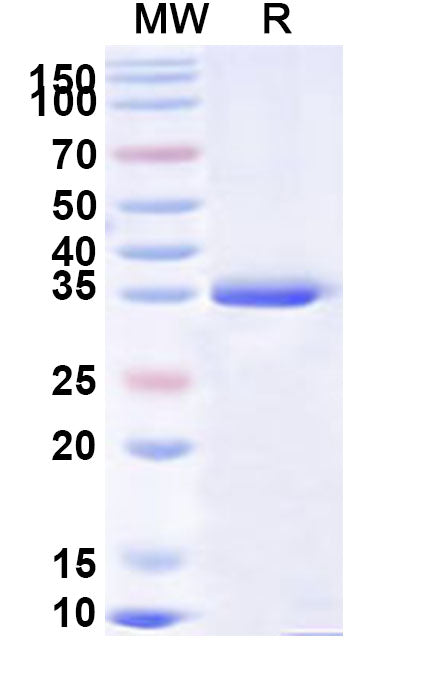 Recombinant Human EYA2 Protein, N-His
