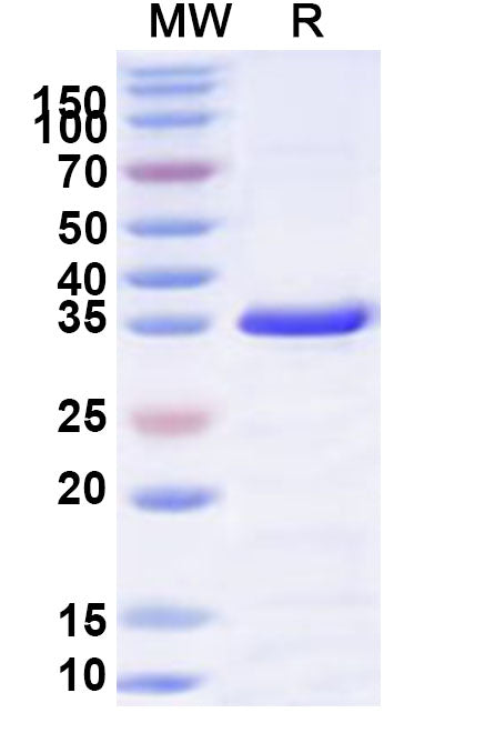 Recombinant Human AP4M1 Protein, N-His