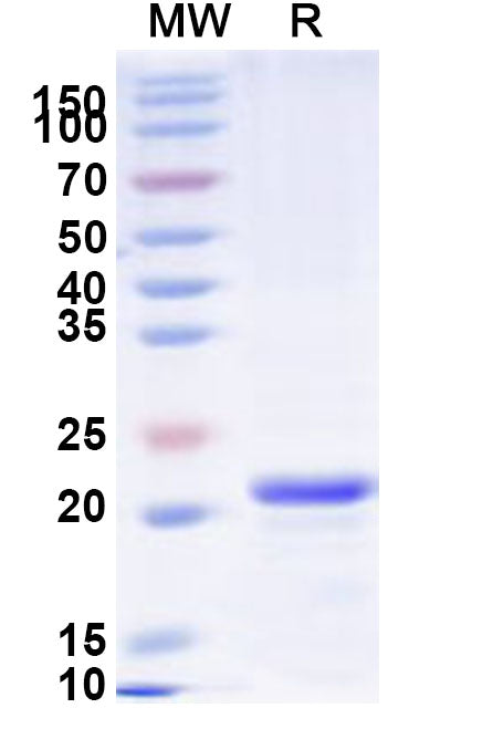 Recombinant Human SCAMP1 Protein, N-His