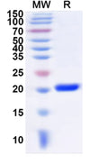 Recombinant Human POU6F1 Protein, N-His