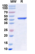 Recombinant Human RNF126 Protein, N-His