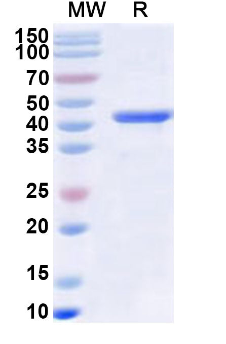 Recombinant Human RNF126 Protein, N-His