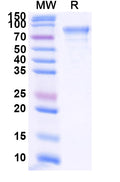 Recombinant Human B4GALT1 Protein, C-Fc