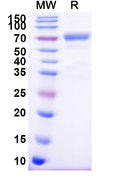 Recombinant Human CD158b1/KIR2DL2 Protein, C-Fc