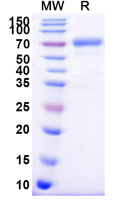 Recombinant Human CD158b1/KIR2DL2 Protein, C-Fc