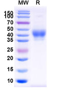 Recombinant Human CD158b1/KIR2DL2 Protein, C-His