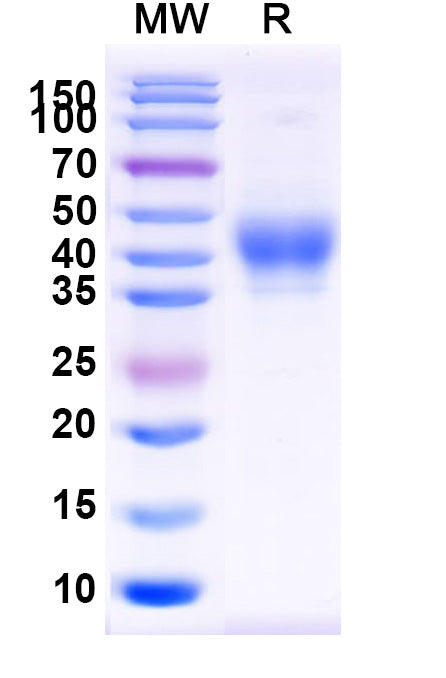 Recombinant Human CD158b1/KIR2DL2 Protein, C-His
