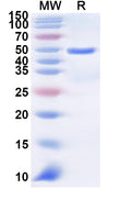 Recombinant Human SLC36A1 Protein, N-GST & C-His