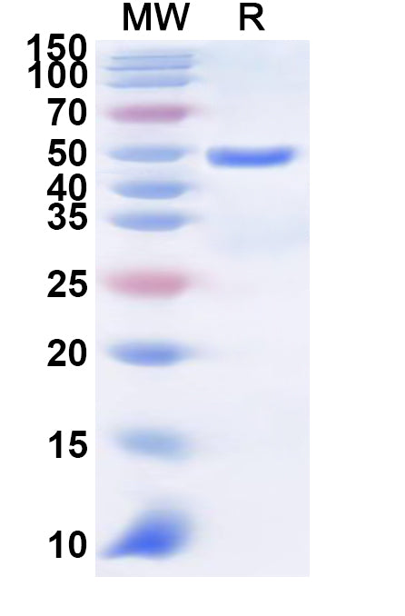 Recombinant Human SLC36A1 Protein, N-GST & C-His