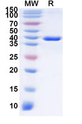 Recombinant Human SLC7A10 Protein, N-GST & C-His