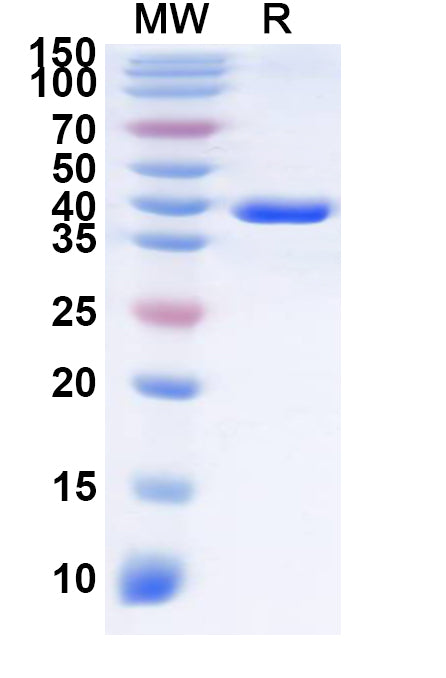 Recombinant Human SLC7A10 Protein, N-GST & C-His