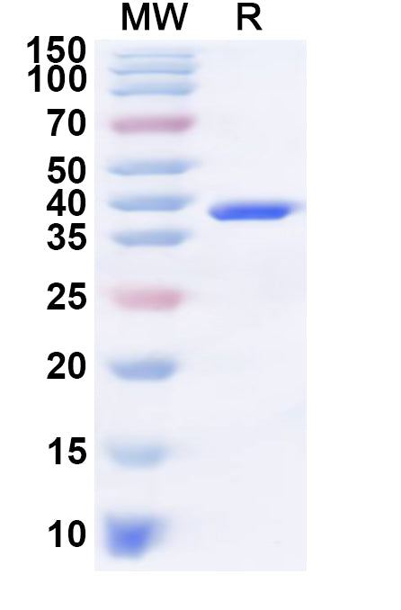 Recombinant Human RABAC1 Protein, N-GST & C-His