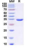 Recombinant Human ELOVL6 Protein, N-GST & C-His