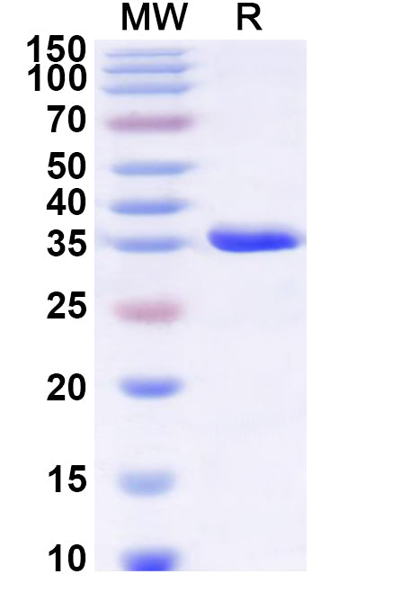 Recombinant Human IFITM1 Protein, N-GST & C-His