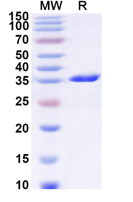 Recombinant Human ICMT Protein, N-GST & C-His
