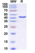 Recombinant Human TIMM22 Protein, N-GST & C-His