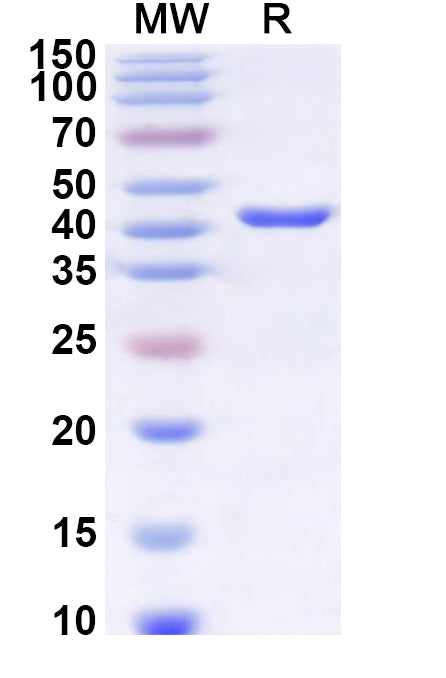Recombinant Human TIMM22 Protein, N-GST & C-His