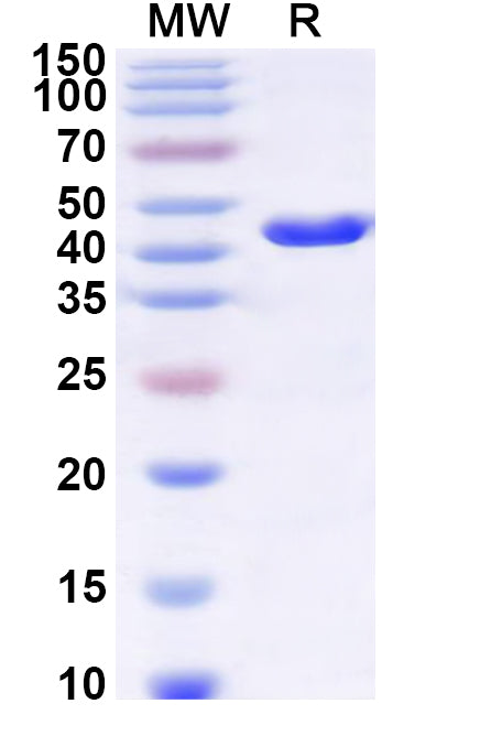 Recombinant Human SLC25A1 Protein, N-GST & C-His