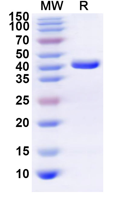 Recombinant Human MTFP1 Protein, N-GST & C-His
