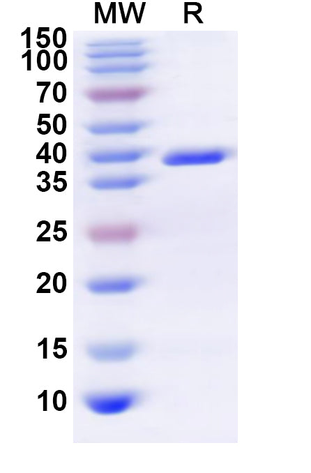 Recombinant Human ADORA1 Protein, N-GST & C-His