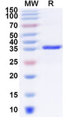 Recombinant Human TIMM17B Protein, N-GST & C-His