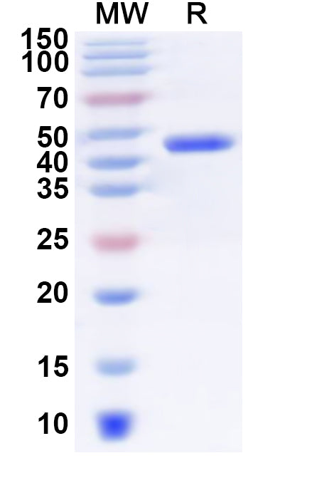 Recombinant Human SLC10A2 Protein, N-GST & C-His